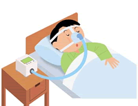 CPAP(シーパップ)