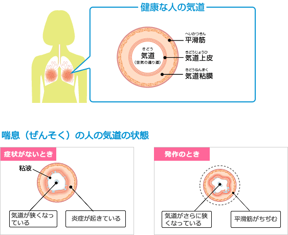 copdに使用するお薬